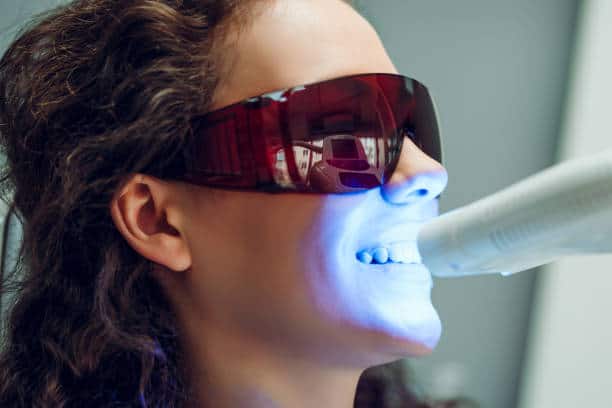 Can the Laser Teeth Whitening Process Be Adjusted for Uneven Tooth Colour Abingdon